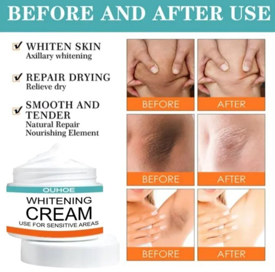 Sensitive Area Whitening Cream