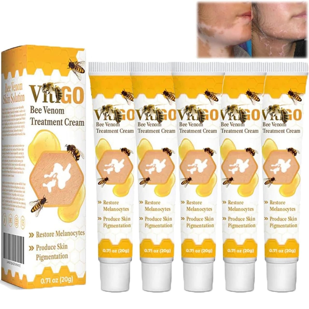 Fivfivgo™ VitiGO Bee Venom Correcting Cream